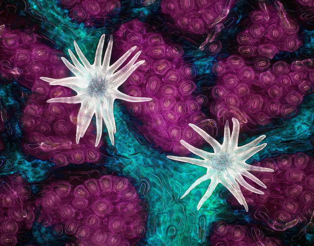 nikon small world Trichome (white appendages) and stomata (purple pores) on a southern live oak leaf